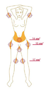 Double Minceur Ciblee